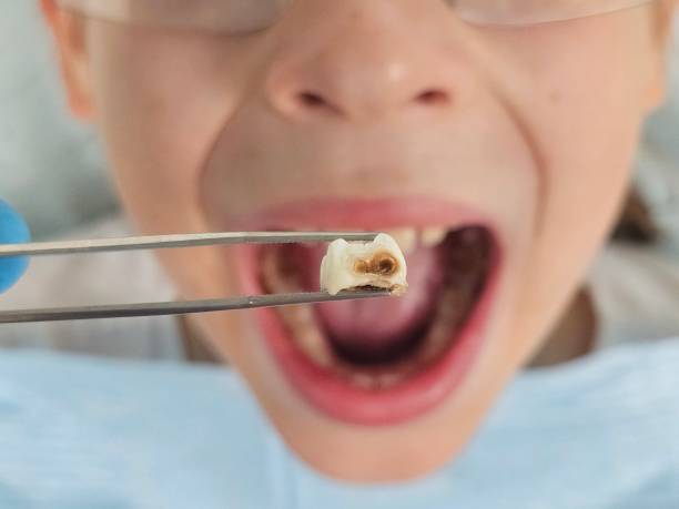 Best Cosmetic Emergency Dentistry in Groveton, VA